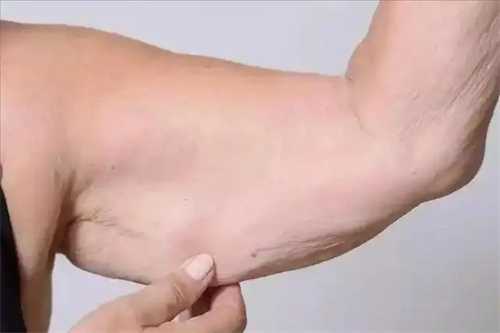 图片细节